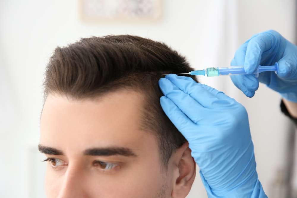 Haarausfall Nürnberg: Verjüngen Sie Ihr Aussehen mit modernen ästhetischen Behandlungen