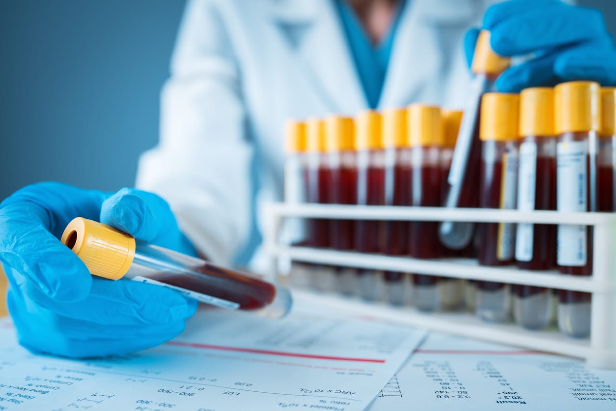 Sicherheit im Labor beginnt bei der Präanalytik